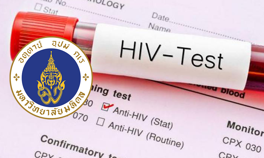 261120 HIVtest